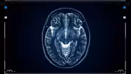 Causes Of Addiction Relapse