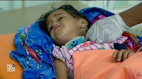 Video thumbnail: PBS NewsHour Diphtheria takes a deadly stranglehold on war-torn Yemen