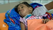 Diphtheria takes a deadly stranglehold on war-torn Yemen