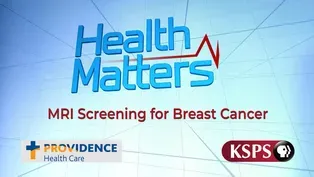 MRI Screening and Breast Cancer