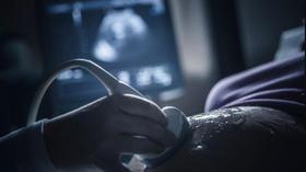 Video thumbnail: PBS NewsHour Why abortion opponents support Trump's Title X rule change