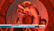 Understanding Breast Cancer - Preview