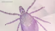 DEADLY LYME SEASON: HILFIGER’S TICK TALE