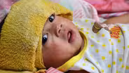 MEASLES: STATE OF EMERGENCY!