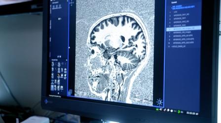 How Does a Brain on THC Compare to a Brain on CBD?