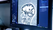 How Does a Brain on THC Compare to a Brain on CBD?