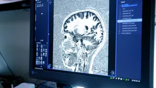 How Does a Brain on THC Compare to a Brain on CBD?