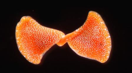 Video thumbnail: Deep Look These Solar-Powered Carnivorous Flatworms Divide and Conquer