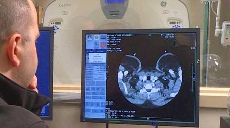 Video thumbnail: KLRN SciTech Now Nov. 15, 2018 | Rapid Stroke technology