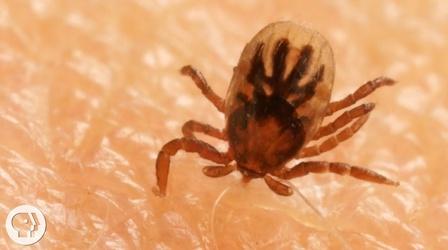 Video thumbnail: Deep Look How Ticks Dig In With a Mouth Full of Hooks