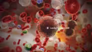Leukemia: Blood Cells Out of Control – Preview