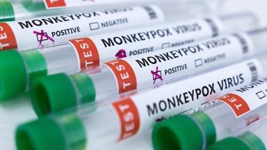 Monkeypox virus spreads amid struggle to contain COVID-19
