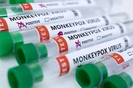 Monkeypox virus spreads amid struggle to contain COVID-19