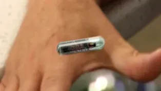 Wisconsin Company Offers to Voluntarily Microchip Employees