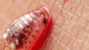 Beware of Flesh-Eating Sand Piranhas at the Beach