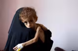 Fighting, starvation and disease yield grim crisis in Yemen