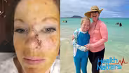 A Young Mom's Skin Cancer Warning