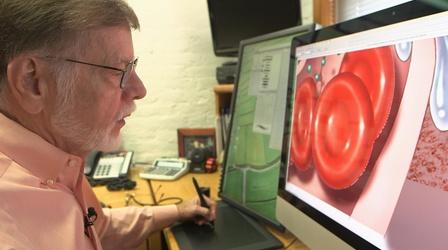 Video thumbnail: AHA! A House for Arts Westwood Medical Illustrations
