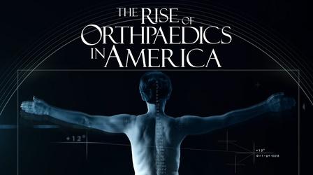 Video thumbnail: The Rise of Orthopaedics in America The Rise of Orthopaedics in America