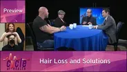 Hair Loss and Solutions