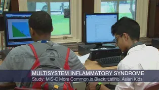 Study: MIS-C More Common in Black, Latino and Asian Kids