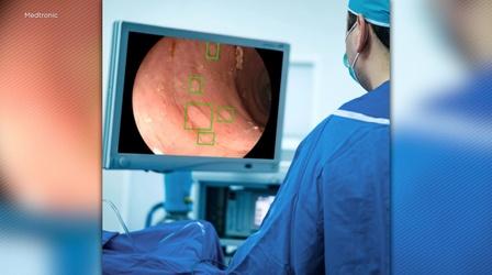 New technology can detect pre-cancerous polyps