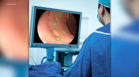 Video thumbnail: NJ Spotlight News New technology can detect pre-cancerous polyps