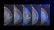 AI And Health
