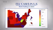 Flu cases on the rise in NJ