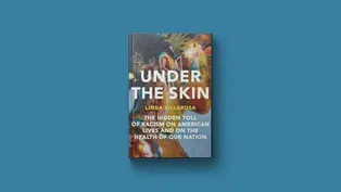 'Under the Skin' looks at systemic racism's toll on health