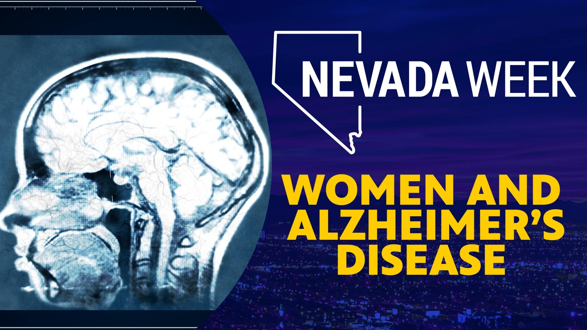 Alzheimer’s Disease can be different for everyone and researchers at UNLV want to know why.