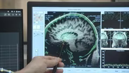 Resolve to Solve with Miles O Brien - Mindshift: Rewiring the Human Brain Preview