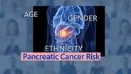 Pancreatic Cancer Treatment | Focus on Health