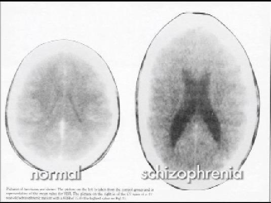 Other Disorders