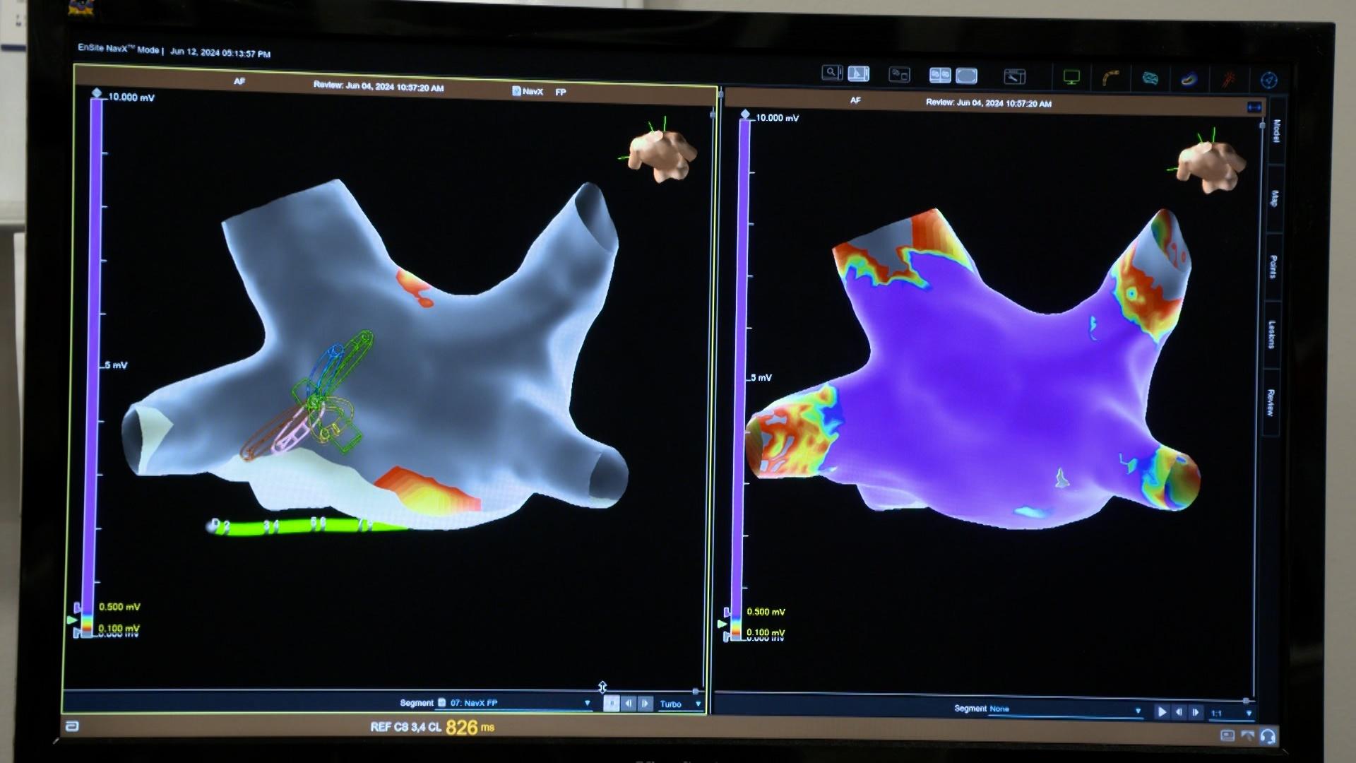 Living in the Lehigh Valley Living in the Lehigh Valley: Updated
