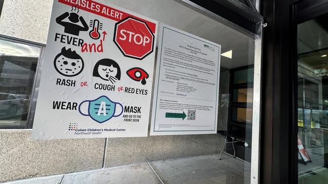 Measles cases surge to highest levels in over 30 years