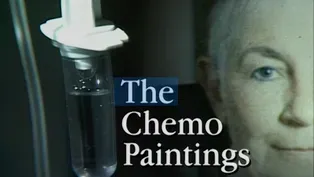 Chemo Paintings