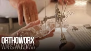 Orthoworx - It's A Joint Effort