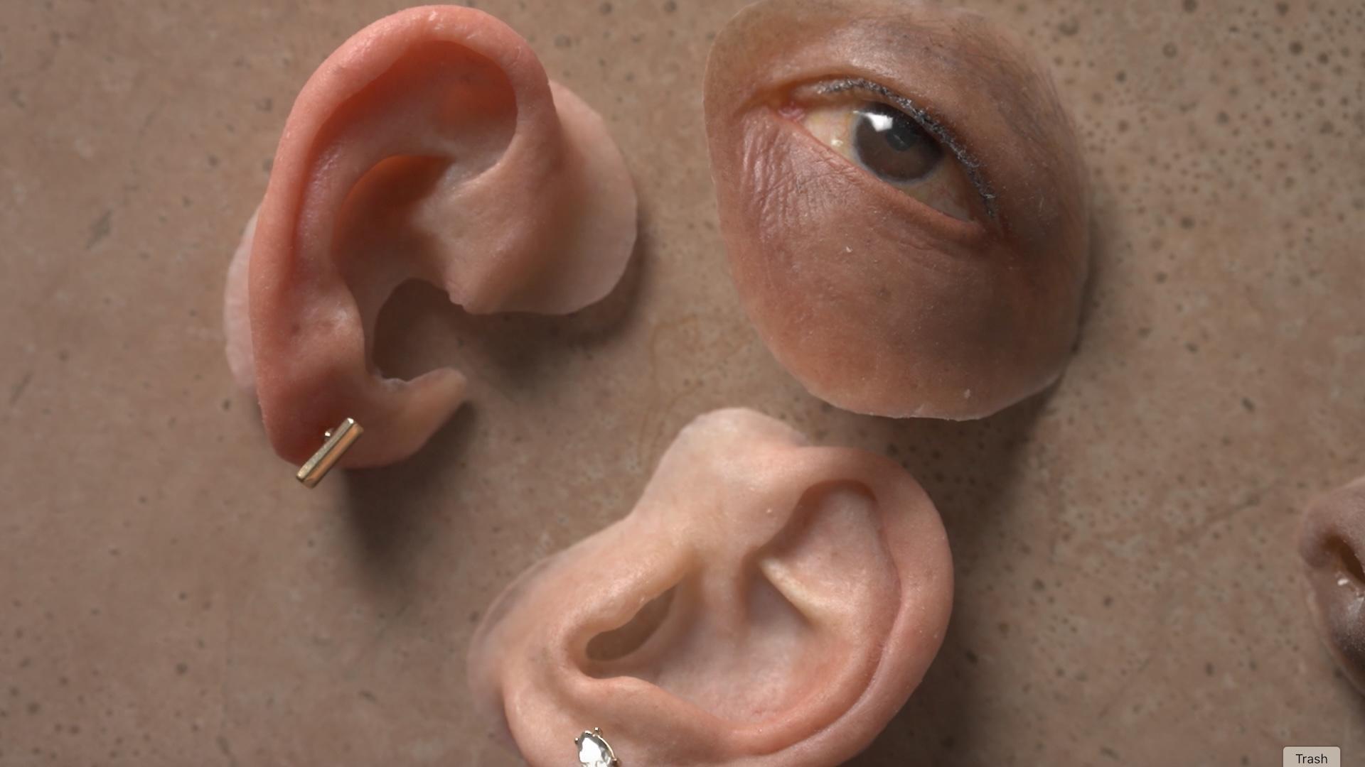 Facial Prosthetics