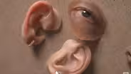 Facial Prosthetics