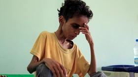 Video thumbnail: PBS NewsHour What war-torn Yemen needs to keep more children from dying