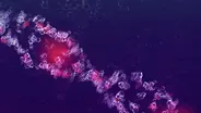 Living with Autoimmune Disease - Preview