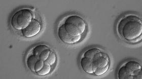 Video thumbnail: PBS NewsHour This gene-editing milestone raises big ethical questions
