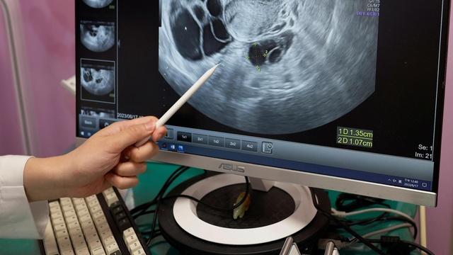 How new ovarian cancer findings may help reduce risk