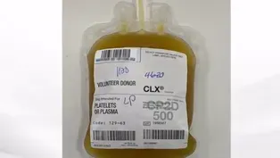 COVID-19 Cure? Convalescent Plasma Therapy Trial Launches