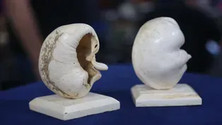 Appraisal: Whale Eardrums, ca. 1935