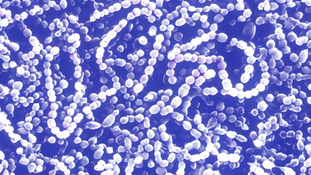 CDC warns of rising strep throat infections among children PBS