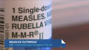 What a National Measles Outbreak Could Mean for Chicagoans