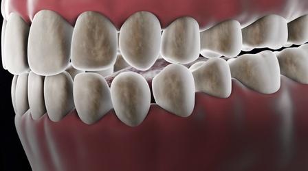 Video thumbnail: Eons The 40 Million-Year-Old Ecosystem In Your Mouth