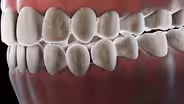 The 40 Million-Year-Old Ecosystem In Your Mouth
